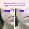 image:imageBLUMBODY Face Wrinkle Patch Complete Mini Set Bundle