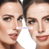 image:imageBLUMBODY Face Wrinkle Patch Complete Mini Set Bundle