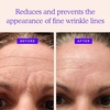 image:imageBLUMBODY Neck Wrinkle Patches and Face Wrinkle Patches Mini and Forehead Bundle Set