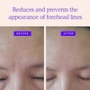 image:imageBLUMBODY Neck Wrinkle Patches and Face Wrinkle Patches Mini and Forehead Bundle Set